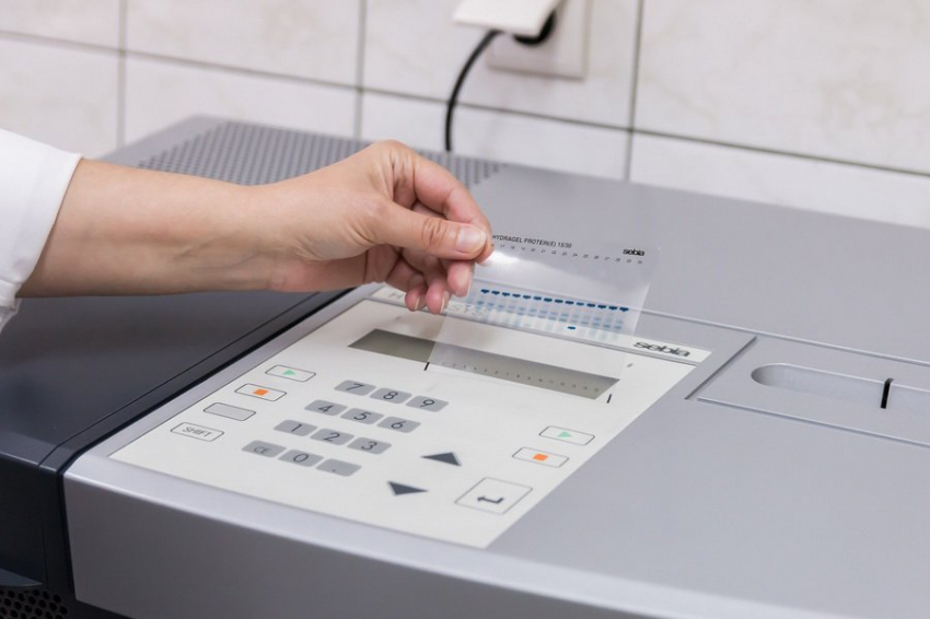 Специалисты БФУ создали метод, улучшающий диагностику эпилепсии